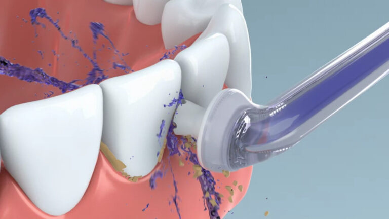 Philips Sonicare AirFloss: Diese Munddusche entfernt den Zahnbelag mit Wasser und Luft