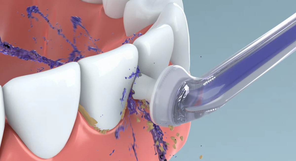Philips Sonicare AirFloss: Diese Munddusche entfernt den Zahnbelag mit Wasser und Luft