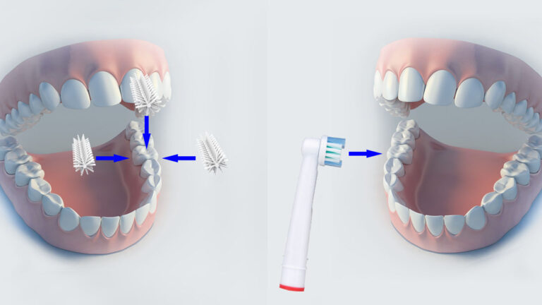 GlareSmile: Zähne putzen in nur zehn Sekunden
