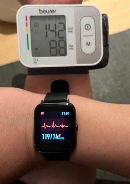 Blutdruckmessung Apple Watch