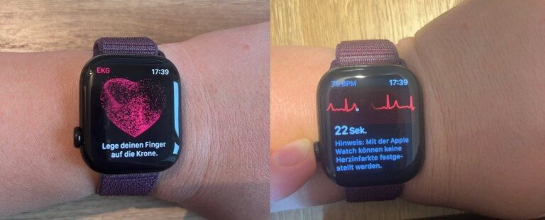 Apple Watch 10 EKG