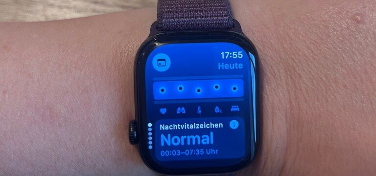 Vitalzeichen AppleWatch