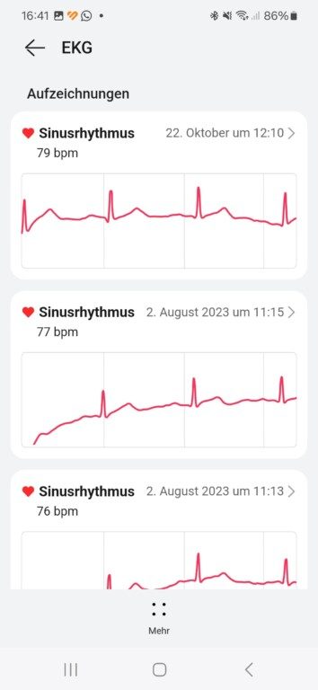 EKG? Na, klar. Ist auch dabei. (Screenshot)